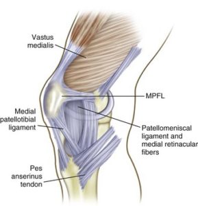 View of the knee along the medial side showing the MPFL