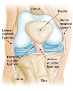 ACL 239x300 Do You Need Surgery for a Torn ACL?