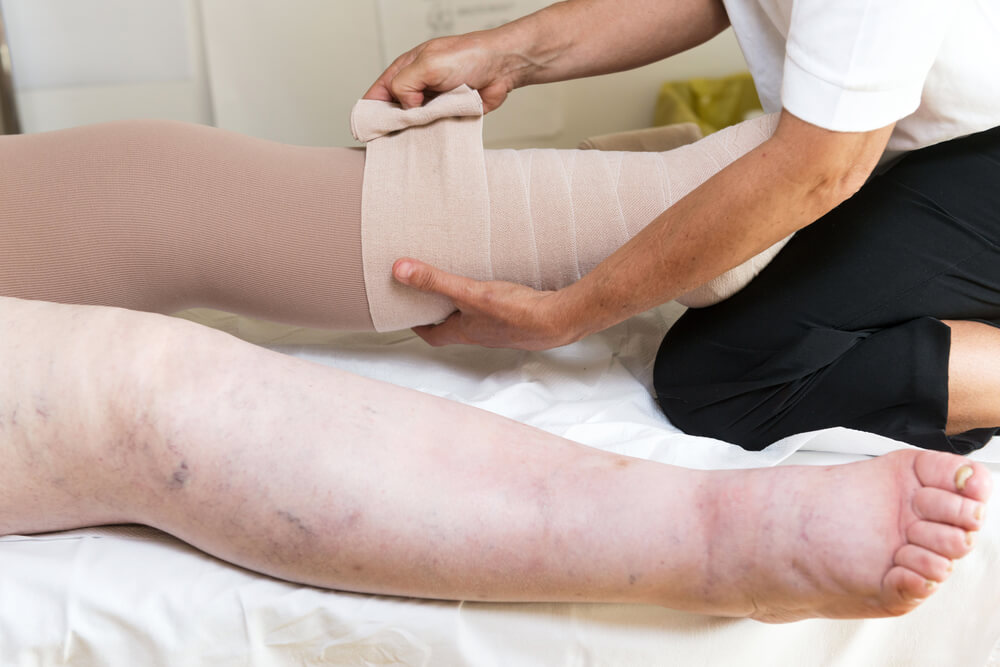 Understanding how lymphedema therapy can help your quality of life lymphedema therapy treatment options lymphedema therapy treatment options