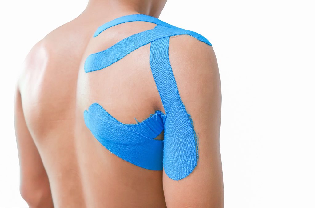 Kinesio taping in St. Charles, MO shutterstock 658262857 benefits of kinesio taping