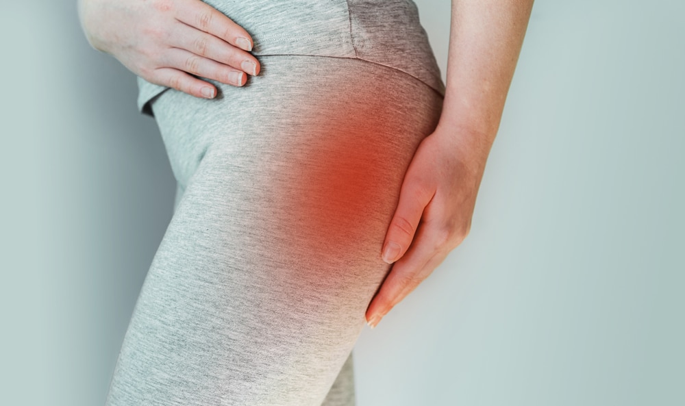 How to Sleep With Piriformis Syndrome