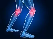 Joint Replacement Academy 2837 1 Joint Replacement Academy